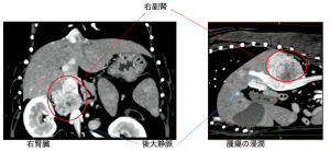 獣医師ブログpart 6 副腎腫瘍と手術症例について 神奈川県西鎌倉の動物病院 小川犬猫病院